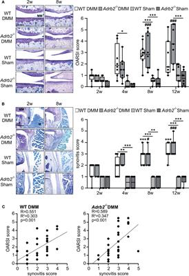 β2-Adrenoceptor Deficiency Results in Increased Calcified Cartilage Thickness and Subchondral Bone Remodeling in Murine Experimental Osteoarthritis